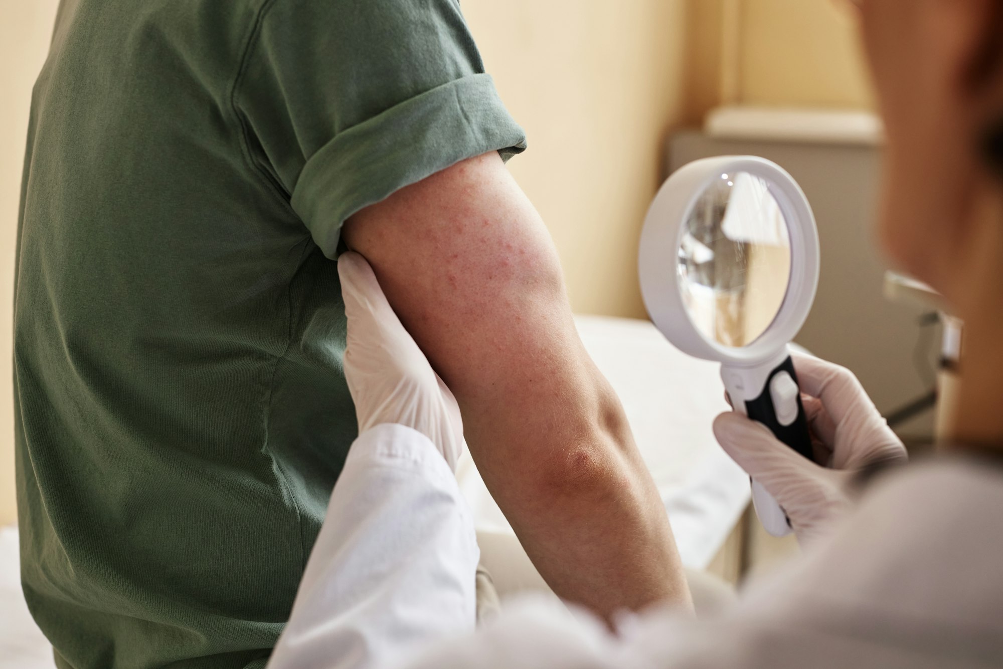 Close up of doctor inspecting skin with magnifying glass