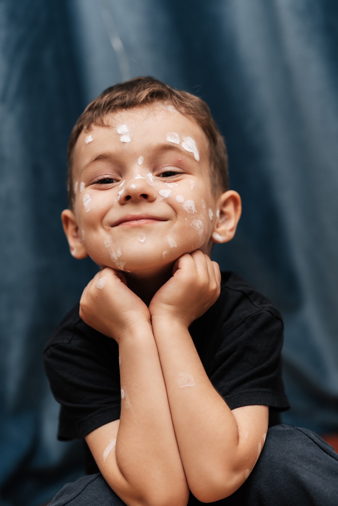 Portrait of a Caucasian boy with chickenpox.