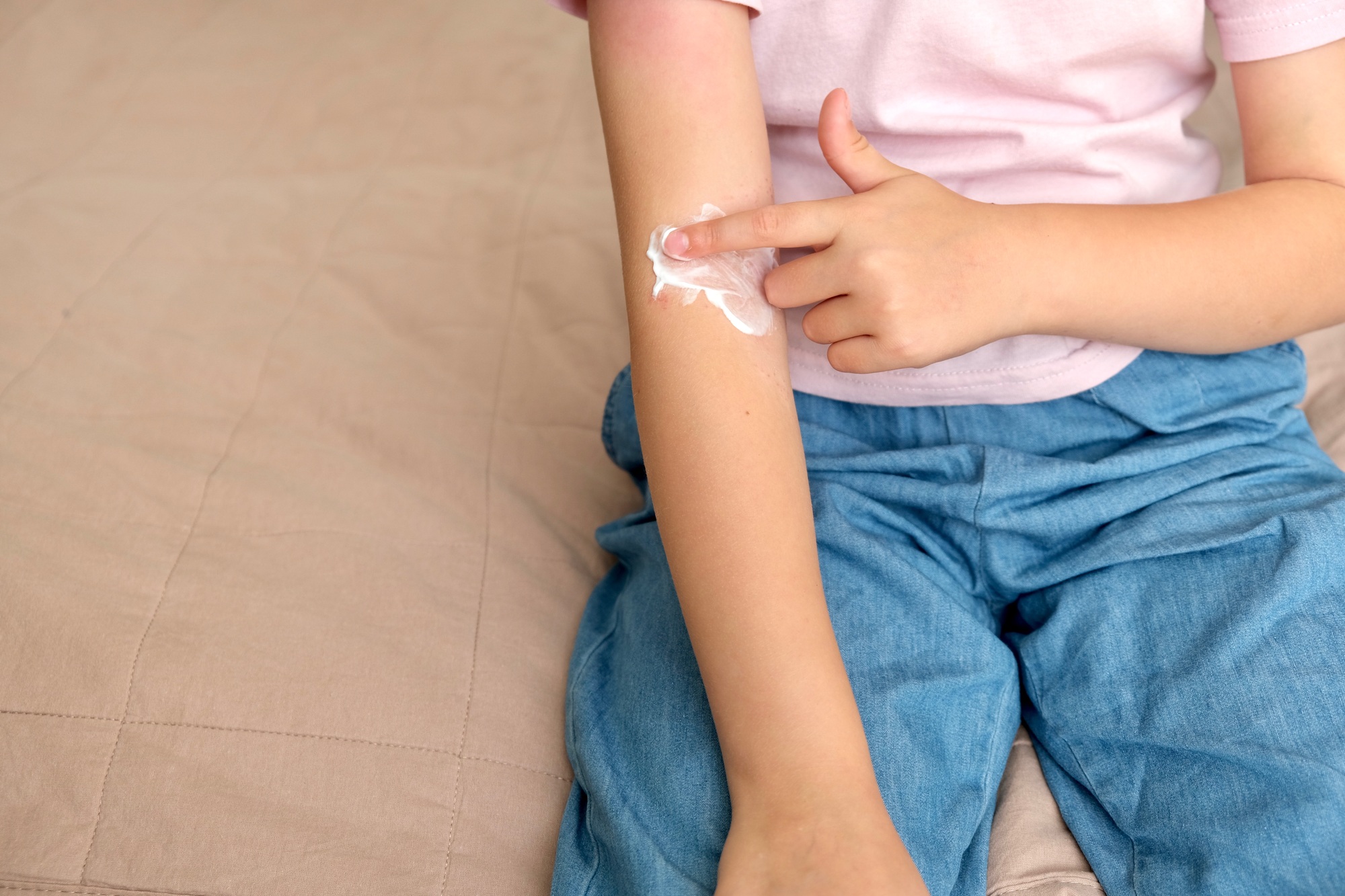 The child applies a special cream to atopic skin.